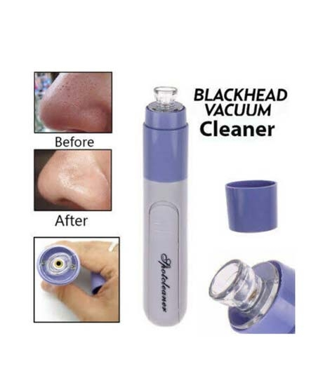 iShopping - Muzamil Store Vacuum Blackhead Removal