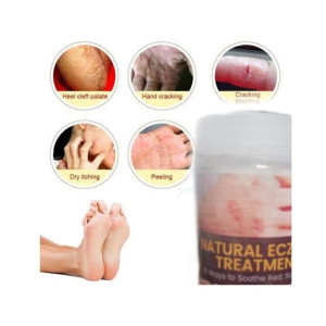 Marham Herbal Hand & Feet Moisturizer Balm Cream