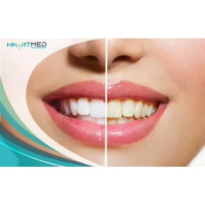 Ayesha's Collection Hismile V34 Teeth Whitening