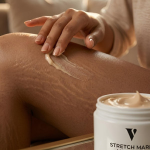 Vcare Natural Stretch Mark Vanishing Cream