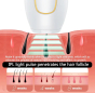 iShopping - 990000 Flash Professional Permanent IPL epilator Laser Hair Removal Electric Women Painless Threading Hair Remover Machine with Sunglasses and Razor - White
