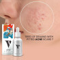 iShopping - Vcare Natural Acne Serum 30ml